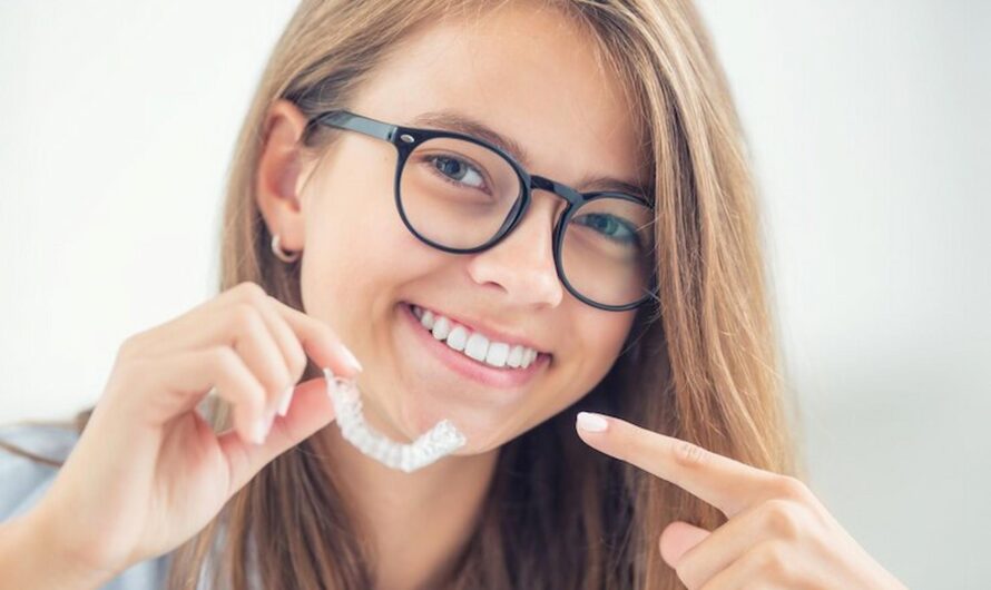 Why Invisalign is the Latest Dental Trend